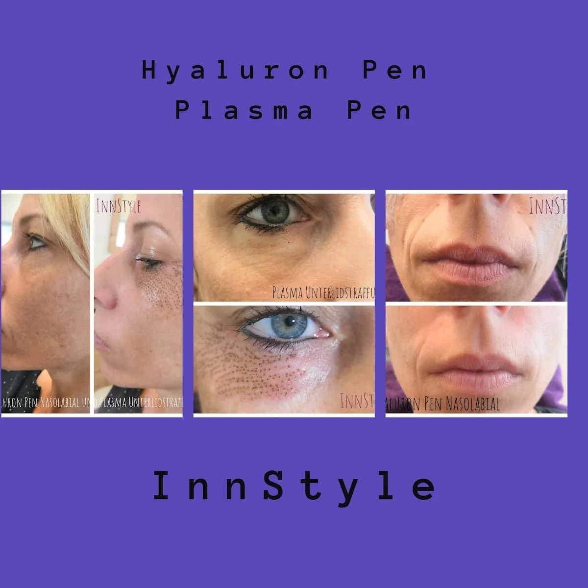 InnStyle, Studio Altheim, Bild 8