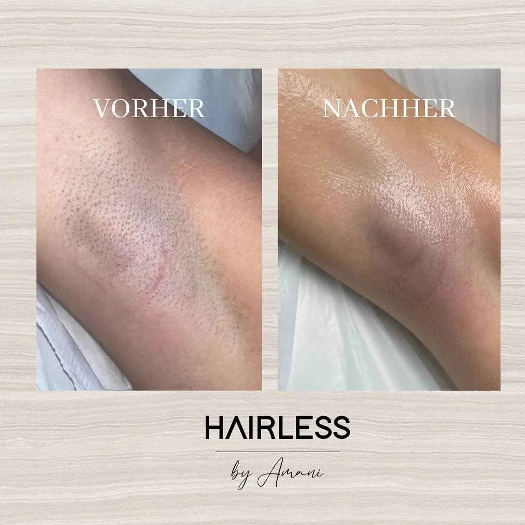 Hairless by Amani, Eindruck 3